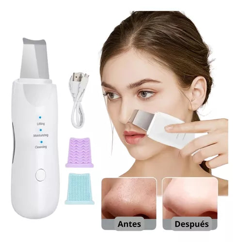 Limpiador Facial Ultrasónico (Ultrasonic cleaning skin)